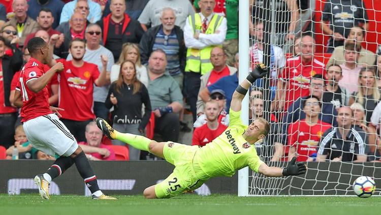 Joe Hart berusaha mengamankan tendangan dari Anthony Martial. - INDOSPORT