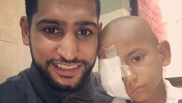 Amir Khan saat membantu bocah asal Pakistan yang terkena tumor mata. Copyright: © mirror.co.uk