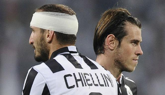 Chiellini dan Bale pasca berbenturan Copyright: Net