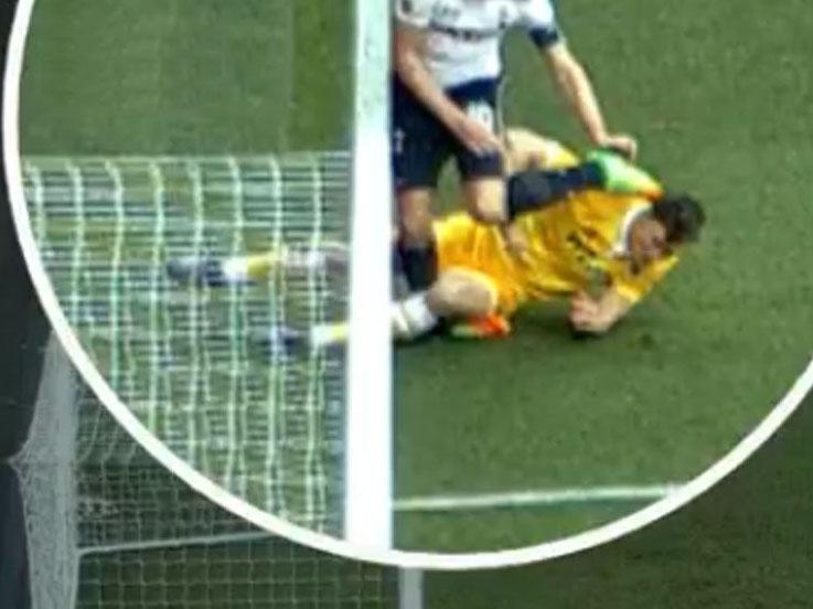 Harry%20kane%20tertangkap%20kamera%20saat%20mendapatkan%20cedera%20parah.