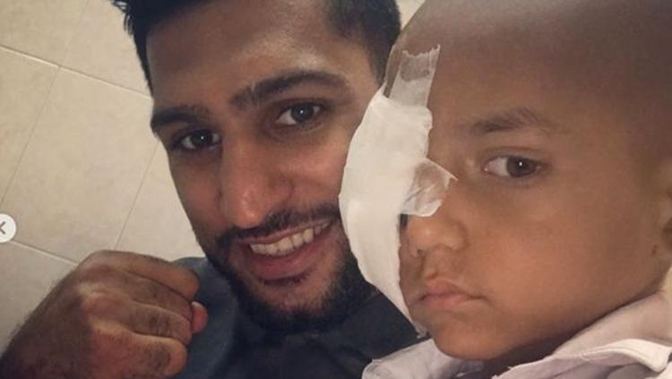 Amir Khan saat membantu bocah asal Pakistan yang terkena tumor mata. Copyright: mirror.co.uk