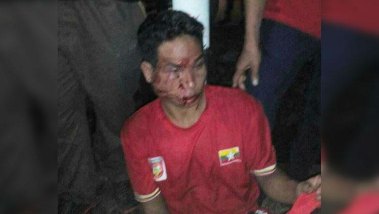 Fans Myanmar yang diduga diserang oleh pendukung Malaysia. Copyright: zing.vn