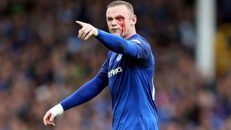 Mata kiri Rooney mengeluarkan darah setelah disikut pemain Bournemouth. Copyright: ESPN FC