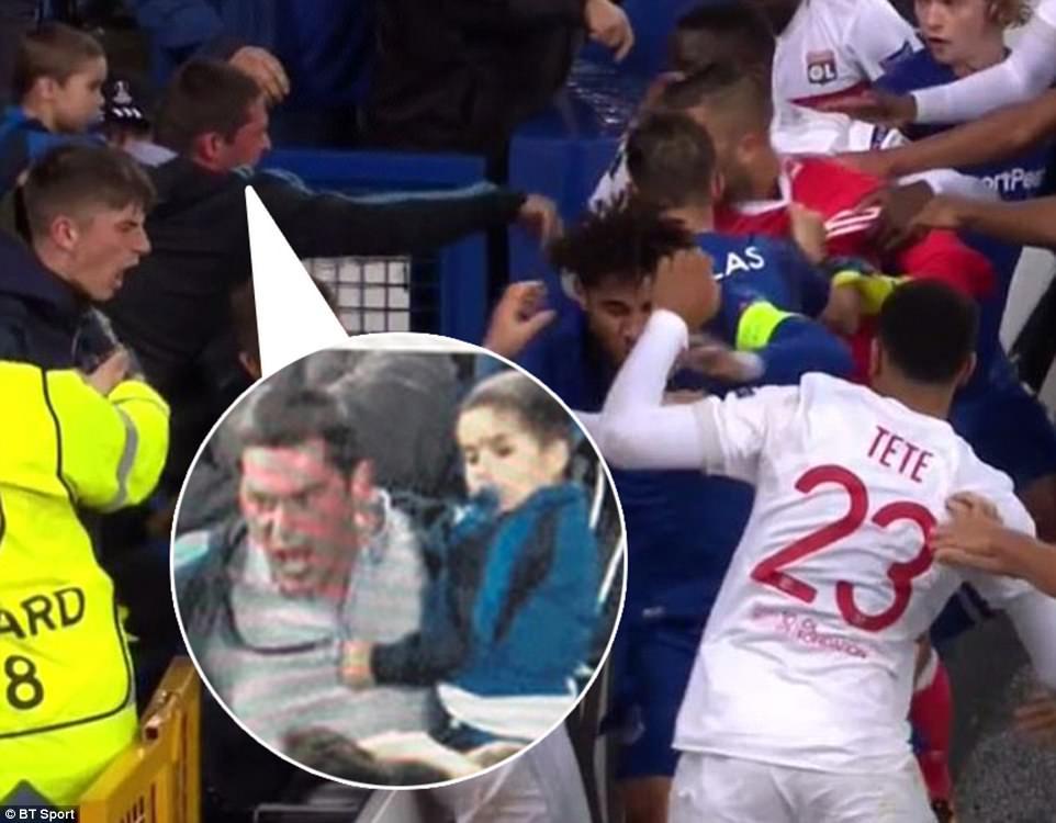 Suporter Everton yang memukul pemain Lyon Copyright: Daily Mail