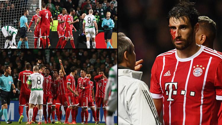 Celtic vs Munchen.