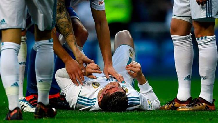 Cristiano Ronaldo saat berdarah-darah melawan Deportivo. Copyright: Mirror