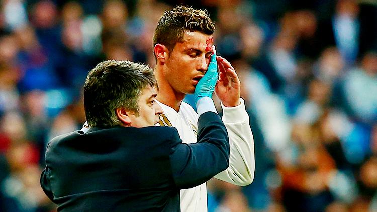 Tim medis menangani Cristiano Ronaldo yang mengalami pendarahan di bagian kepalanya.