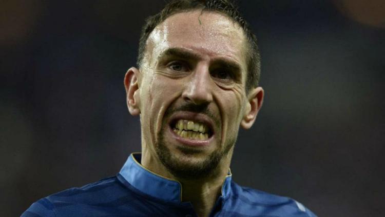 Frank Ribery merupakan salah satu pemain dengan kesehatan gigi buruk