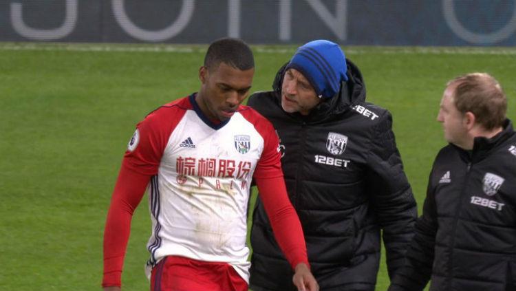 Sturridge mengalami masalah dengan kakinya