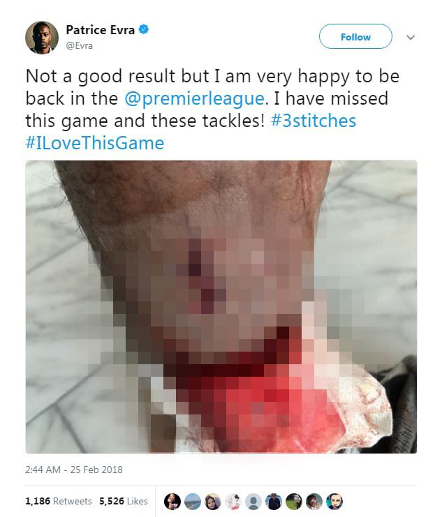 Patrice Evra menjalani debut bersama West Ham Copyright: thesun.co.uk