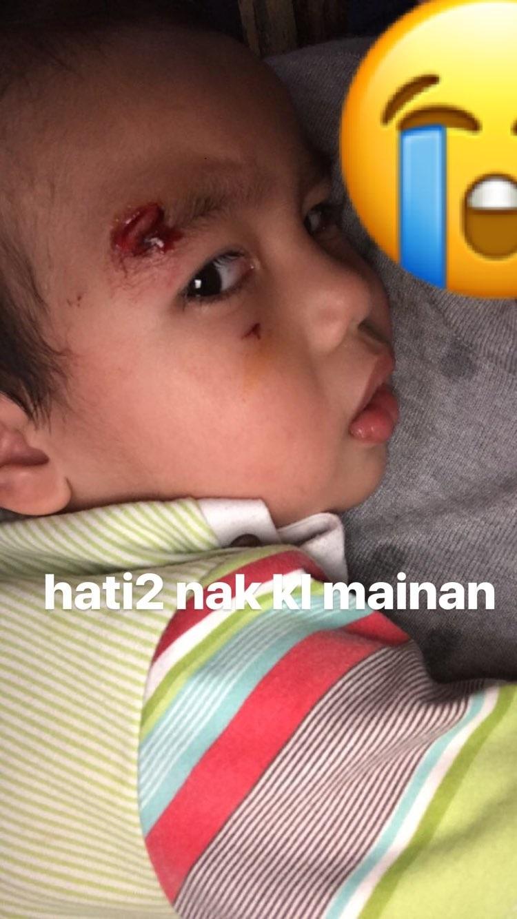 Anak Tontowi Ahmad terdapat luka di bagian kepalanya. Copyright: Instagram@tontowi18