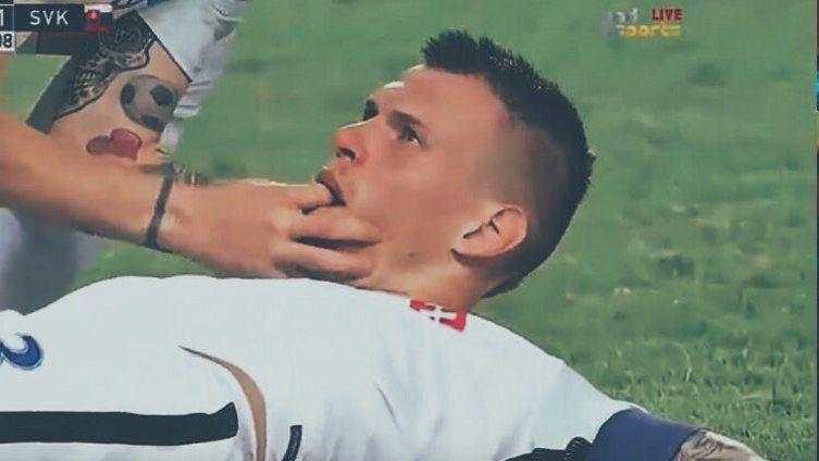Martin Skrtel nyaris merenggang nyawa dengan lidah tertelan.