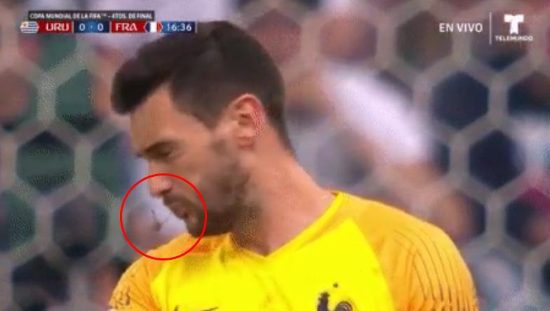 Seekor capung tidak sengaja masuk ke mulut Kiper Timnas Prancis, Hugo Lloris di Piala Dunia 2018. - INDOSPORT