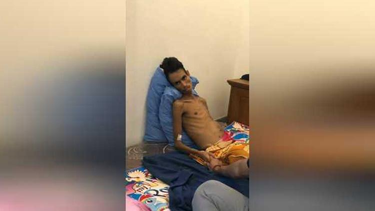 Kondisi terkini Valentinus Nahak petinju Asian Games tinggal tulang. - INDOSPORT