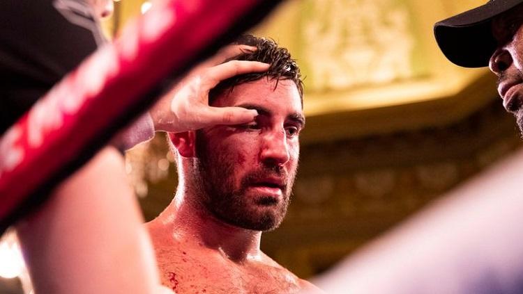 Frank Buglioni alami cedera mata mengerikan