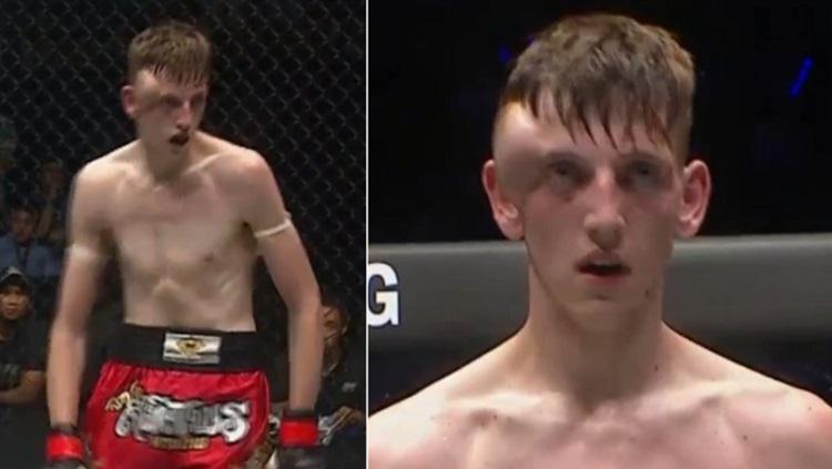George Mann mengalami hematoma. - INDOSPORT