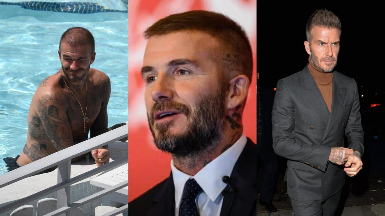 David Beckham diisukan melakukan transpalasi rambut Copyright: The Sun