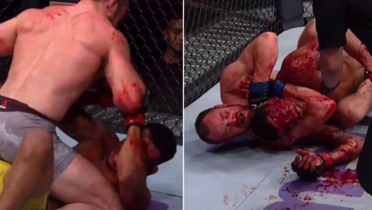 Terjadi pertumbahan darah antara Gunnar 'Gunni' Nelson melawan musuhnya, Alex 'Cowboy' Oliveira. - INDOSPORT