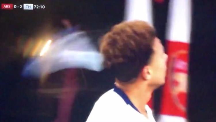 Dele Alli Disambar Botol