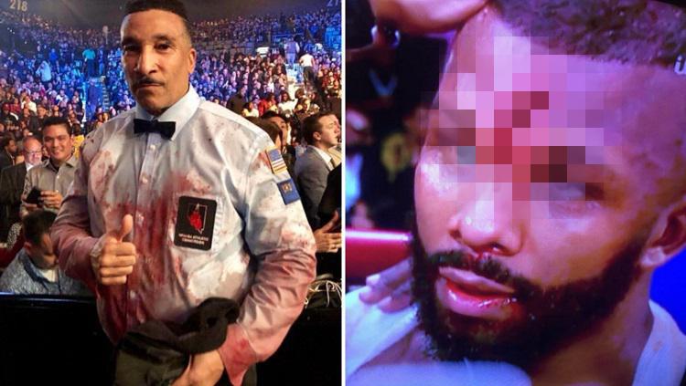 Jack mengalami cedera parah di dahinya yang juga membuat pakaian wasit Tony Weeks berlumuran darah.