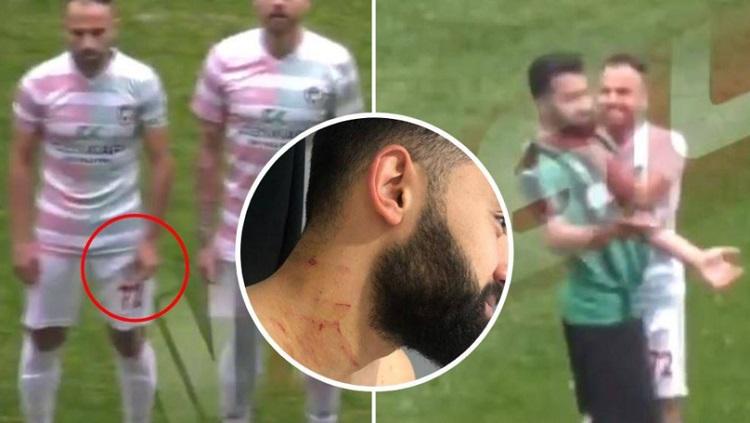 Pemain asal Turki yang dilukai dengan pisau oleh rivalnya