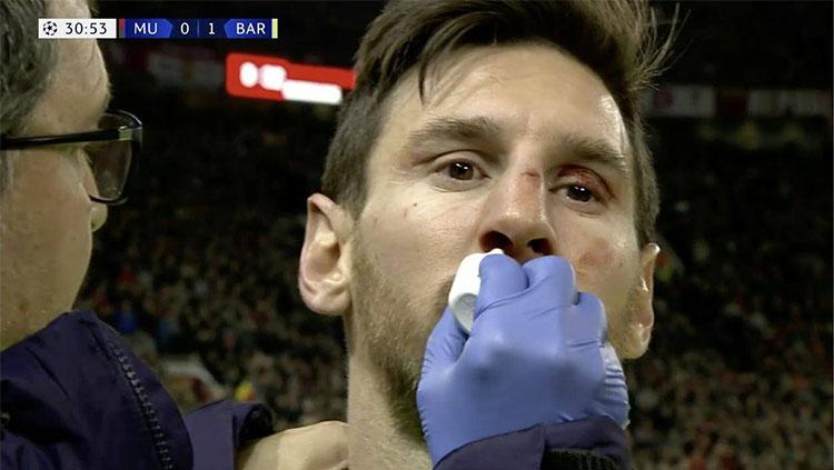 Lionel Messi mendapat perawatan usai ditabrak Chris Smalling saat laga Manchester United vs Barcelona, Kamis (11/04/19) dini hari WIB.
