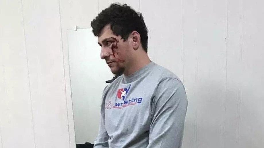 Said Omarov ditangkap dan dihukum dua tahun masa percobaan setelah memicu baku hantam massa di jalan raya Makhachkala. - INDOSPORT
