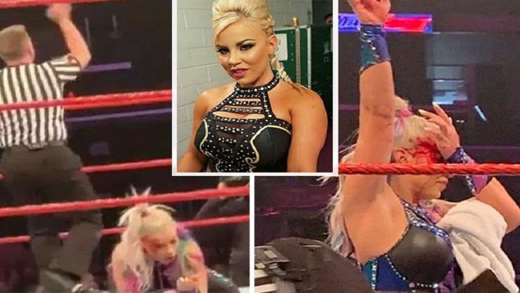 Pegulat WWE, Dana Brooke, mengalami cedera yang cukup parah di bagian kepala. - INDOSPORT