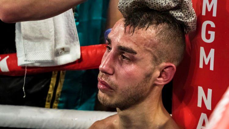 Petinju Rusia, Maxim Dadashev, sempat mengalami cedera dan koma di rumah sakit. - INDOSPORT