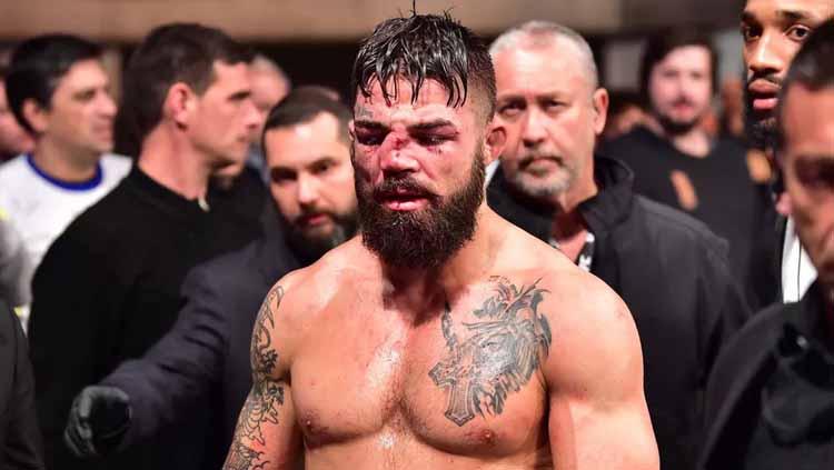 Atlet MMA, Mike Perry, yang hidungnya patah usai terhantam dengkul lawan. Foto: Jason Silva-USA TODAY Sports - INDOSPORT