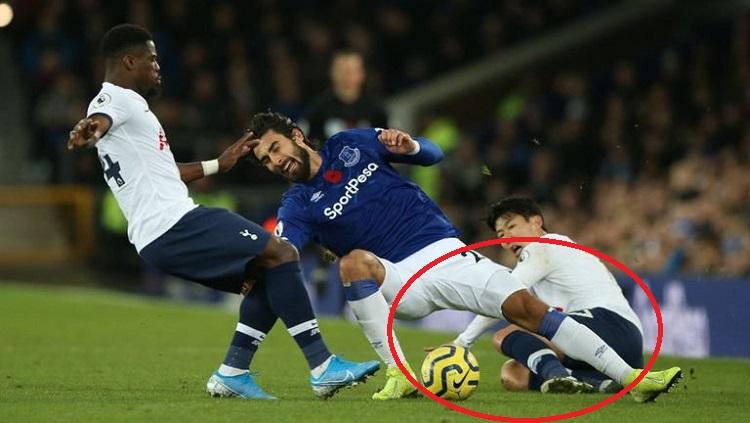 Andre Gomes, harus mengalamai cedera patah kaki usai ditekel oleh Song Heung-min dalam laga pekan ke-11 Liga Inggris di Stadion Goodison Park, Minggu (11/04/19). Copyright: Twitter @AdogaMikeOyi