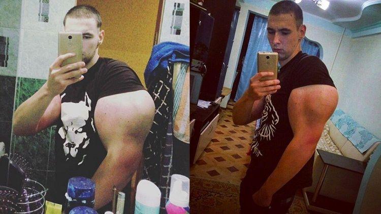 Kirill Tereshin, petarung MMA yang punya otot aneh. - INDOSPORT