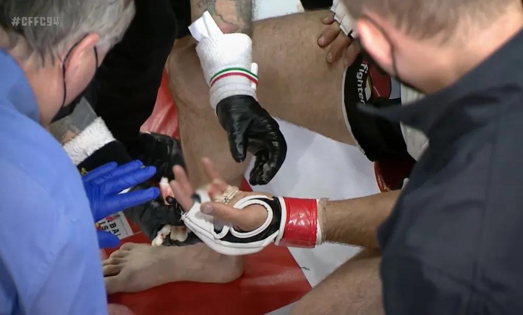 Salah satu jari tangan kiri Khetag Pliev putus saat bertanding di Cage Fury Fighting Championship Copyright: Twitter/caposa