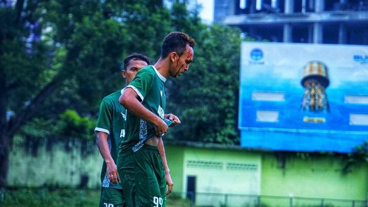 Pemain PSMS Medan, Rachmad Hidayat, terkena luka robek di kepala saat laga uji coba, Jumat (03/09/21).