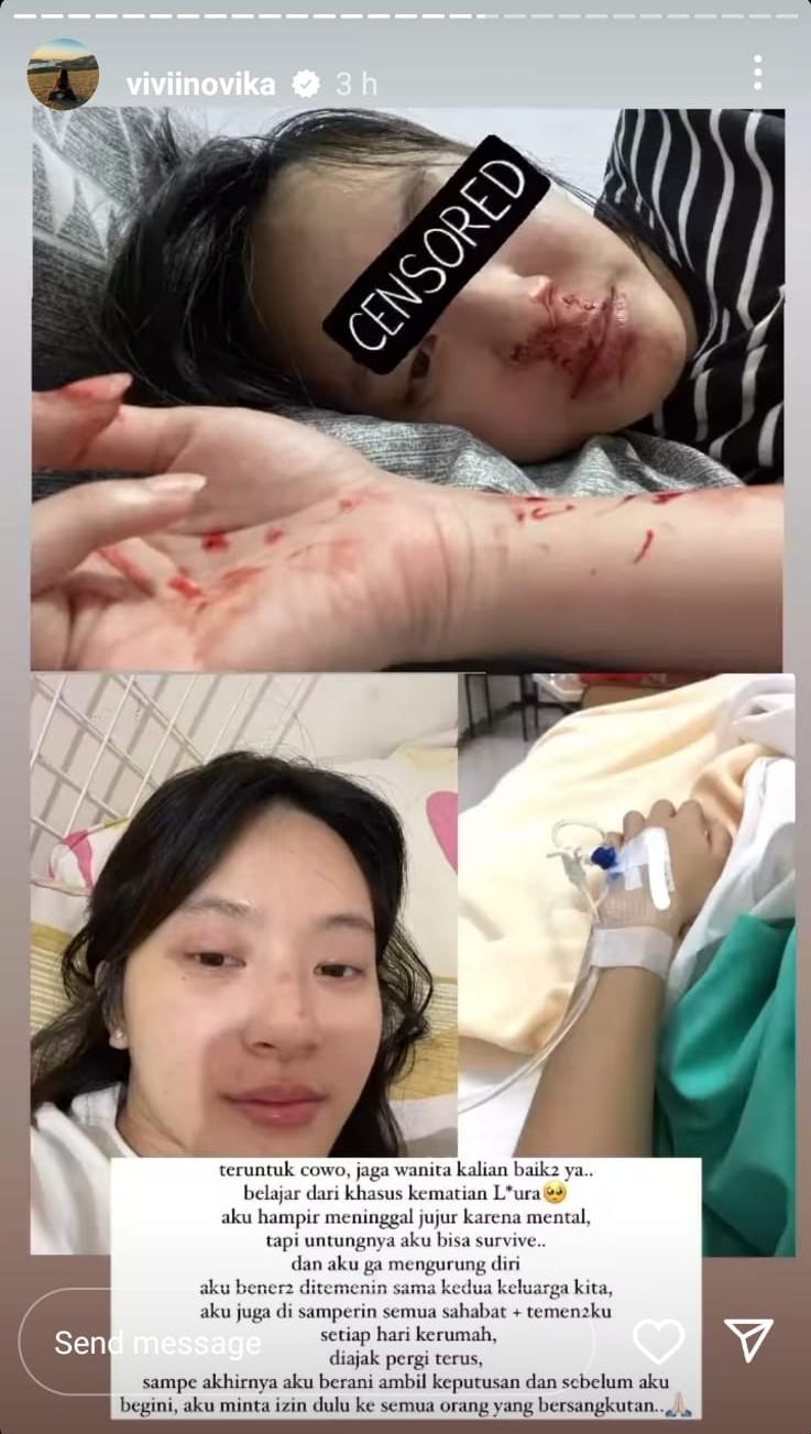 Vivi Novika mengunggah potretnya bersimbah darah saat mengetahui Alfeandra Dewangga selingkuh. Copyright: Instagram @viviinovika