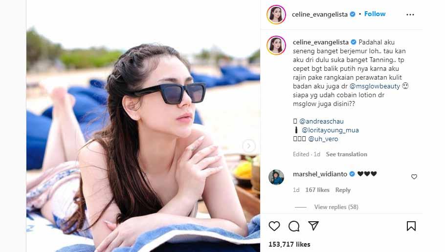 Celine Evangelista tampil seksi dan cantik saat berjemur. Foto: Instagram@celine_evangelista