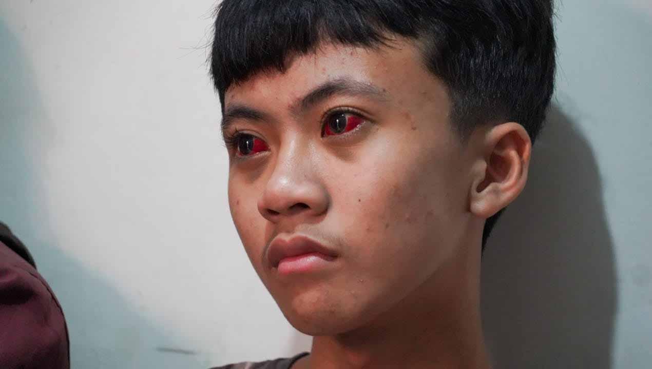 Salah satu korban Tragedi Kanjuruhan yang terjadi di Stadion Kanjuruhan, Malang, pascalaga Arema FC vs Persebaya. (Foto: dokumentasi TGIPF)