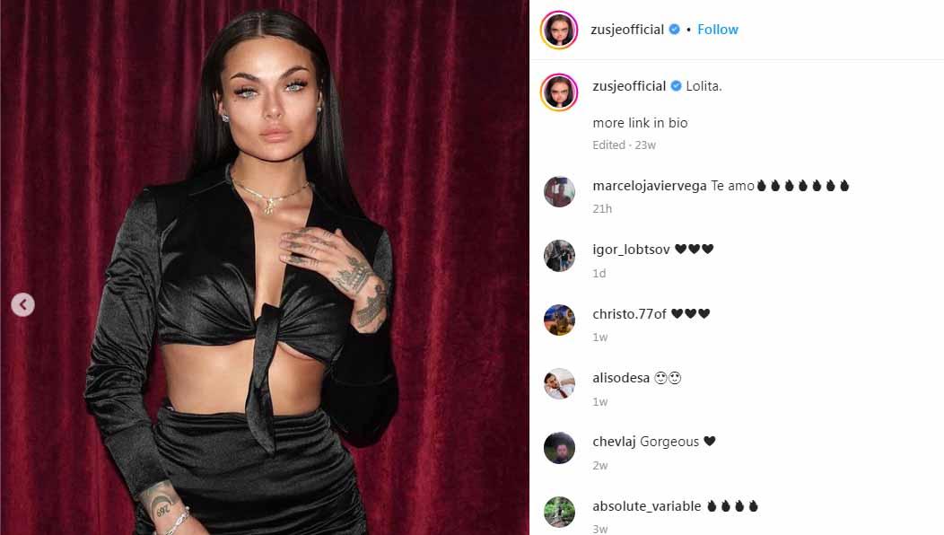 Petarung Mixed Martial Arts (MMA) tercantik dunia, Kamila Smogulecka, memamerkan wajah lebam hingga nyaris tak dikenali usai baku hantam di ring.