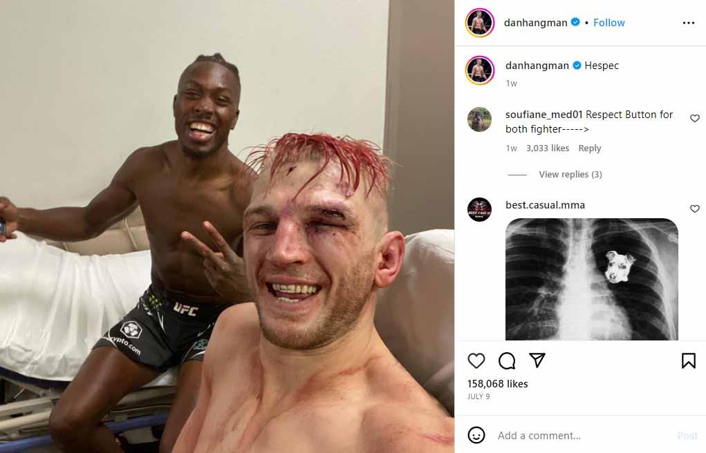 Luka luka Dan Hooker saat bertarung melawan Jalin Turner di UFC 290 di T-Mobile Arena. (Foto: Instagram@danhangman) Copyright: Instagram@danhangman