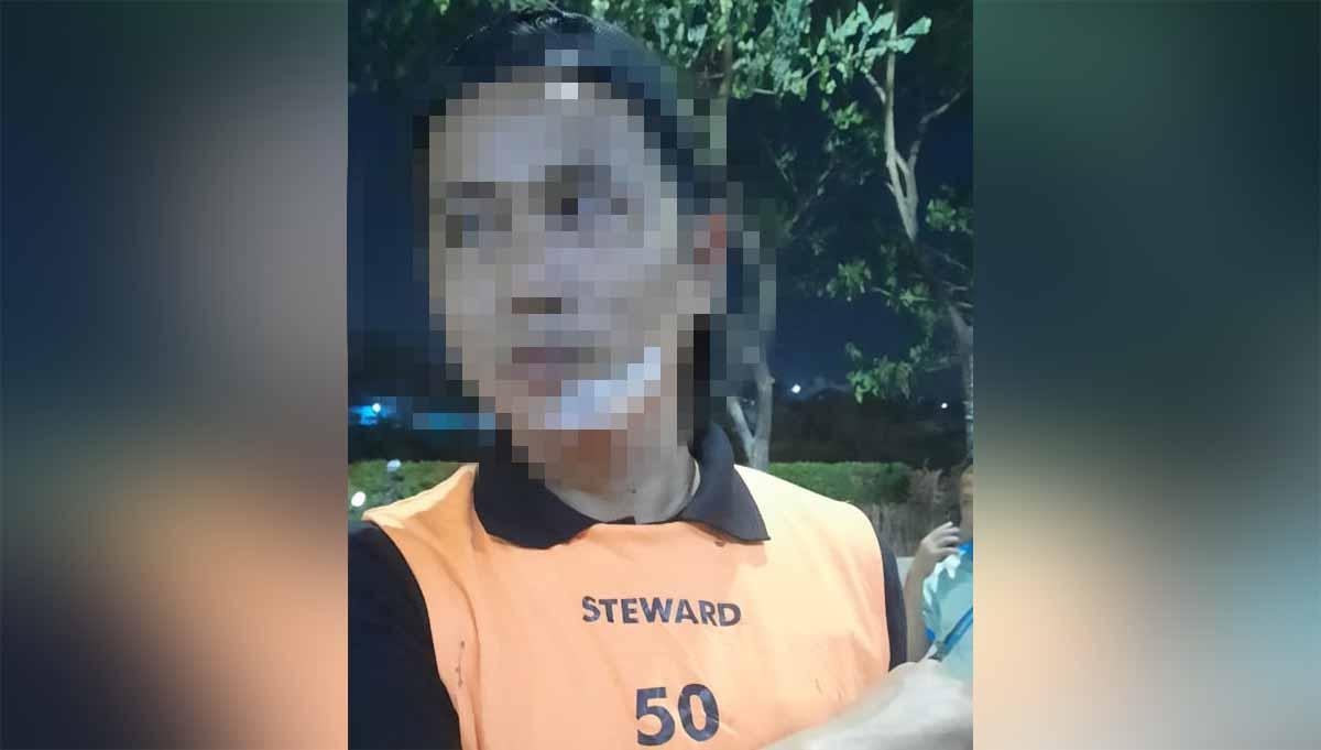 Steward yang amankan laga Dewa United vs PSS Sleman dipukuli oknum suporter PSS Sleman. (Foto: Panpel Dewa United)