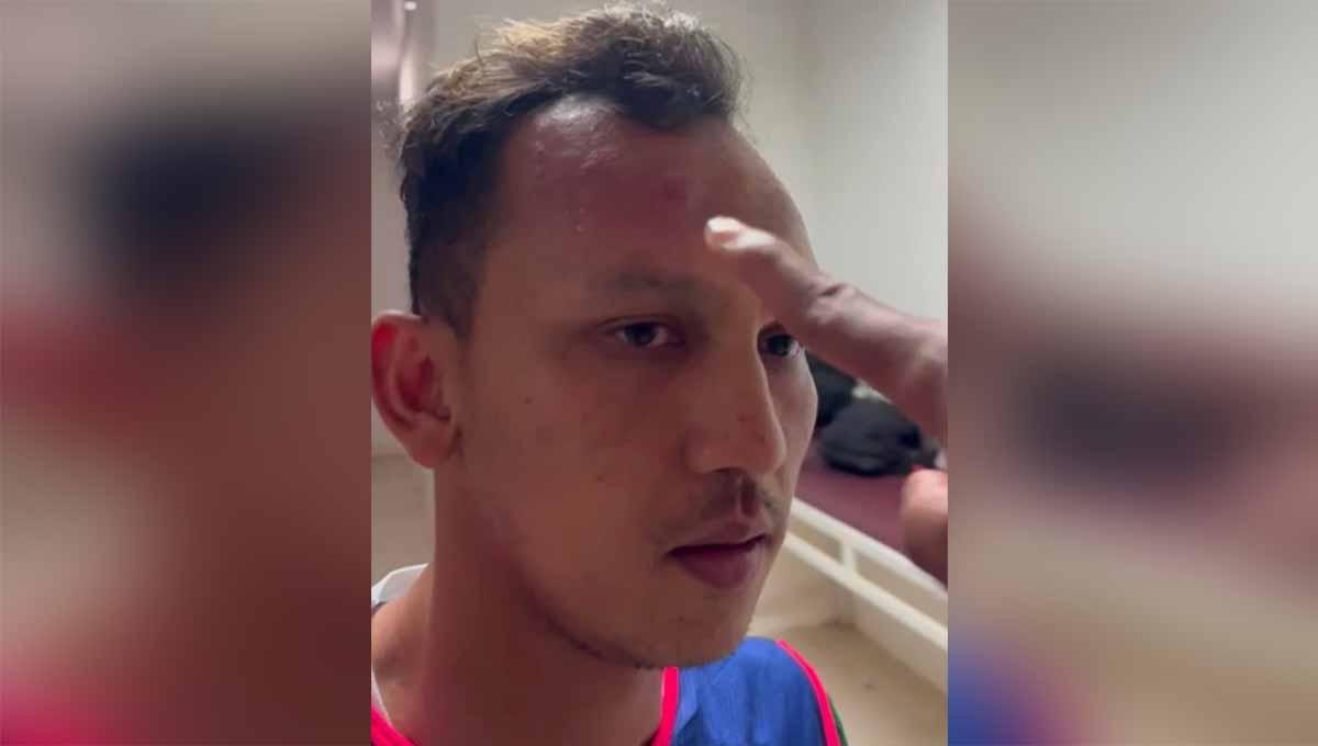 Kapten PSMS Medan, Rachmad Hidayat, diduga dipukul oleh seorang oknum di bagian kepalanya. (Foto: Official PSMS Medan)