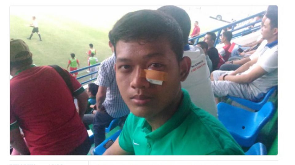 Kondisi kiper timnas U-19, Muhammad Riyandi yang cedera karena berbenturan dengan pemain Myanmar, tahun lalu. Copyright: © INTERNET