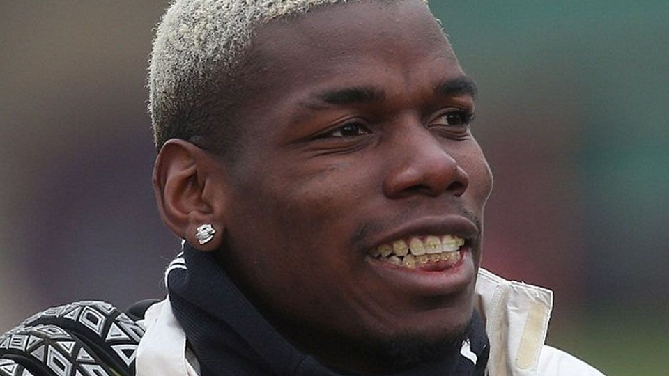 Paul Pogba terlihat menggunakan behel gigi. Copyright: &copy; Man Utd via Getty Images