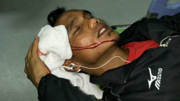 Pemain Semen Padang, Riko Simanjuntak menjadi korban pelemparan oknum suporter. Copyright: &copy; Taufik Hidayat/INDOSPORT