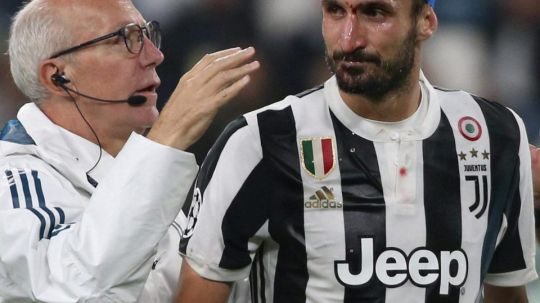 Chiellini mendapat bantuan medis Copyright: © Chiellini berdarah