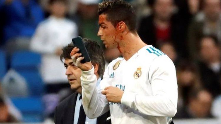 Cristiano Ronaldo saat berdarah-darah melawan Deportivo. Copyright: © Getty Images