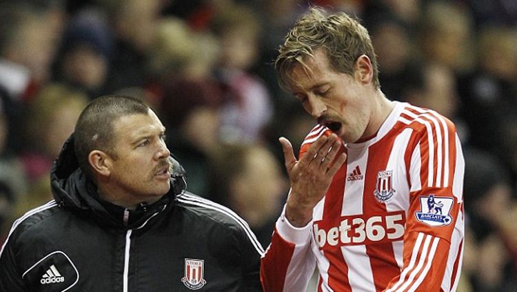 Peter Crouch saat kehilangan gigi. Copyright: &copy; thesun