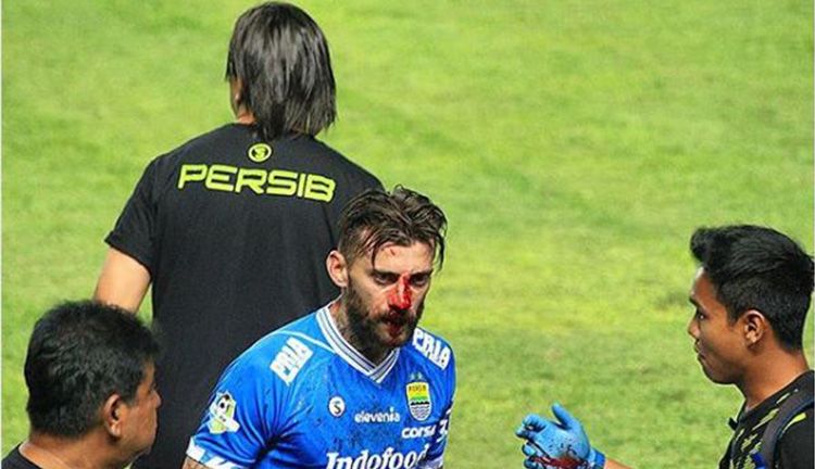 Bojan Malisic mengalami pendarahan Copyright: © Instagram/budihermawan282