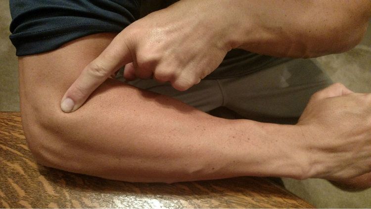 Tennis Elbow Copyright: &copy; Athletes Rehab