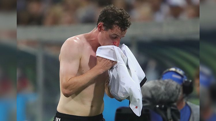 Sebastian Rudy mengelap darah yang keluar dari hidungnya. Copyright: © Getty Images